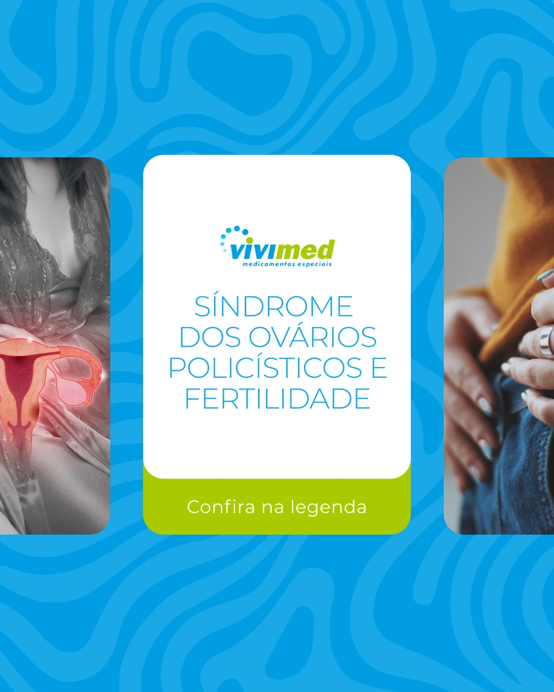 Post sobre síndrome dos ovários policísticos e fertilidade.